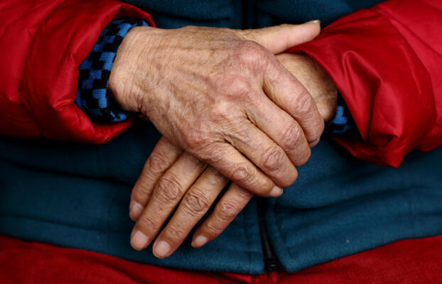 La Francia riconosce il Morbo di Parkinson malattia professionale